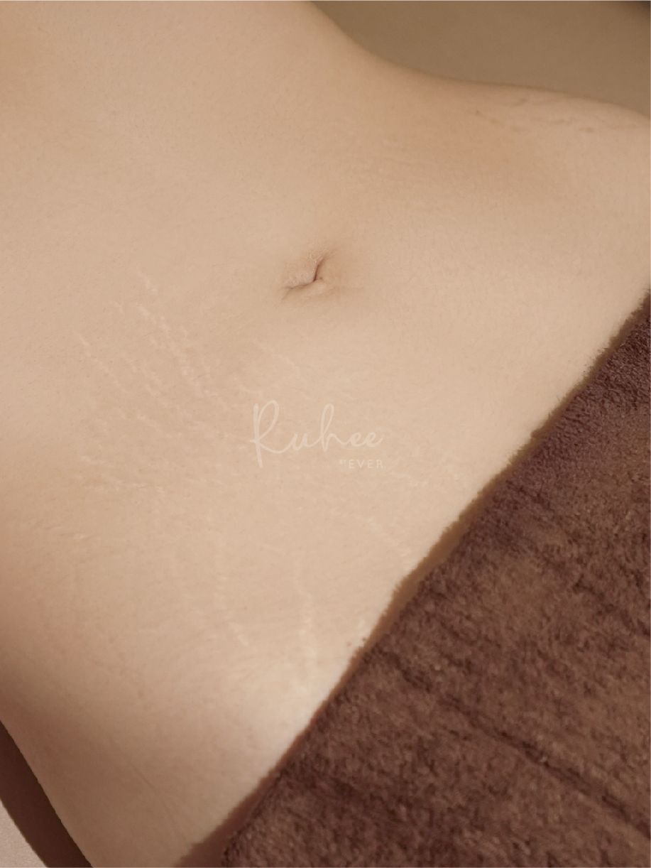 Bikini Waxing